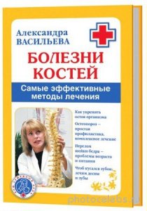  А. Васильева - Болезни костей. Самые эффективные методы лечения (2009) rtf, fb2 